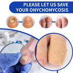 BUY 1 GET 3 – 21pcs Waterproof Toenail Fungus Repair Patches
