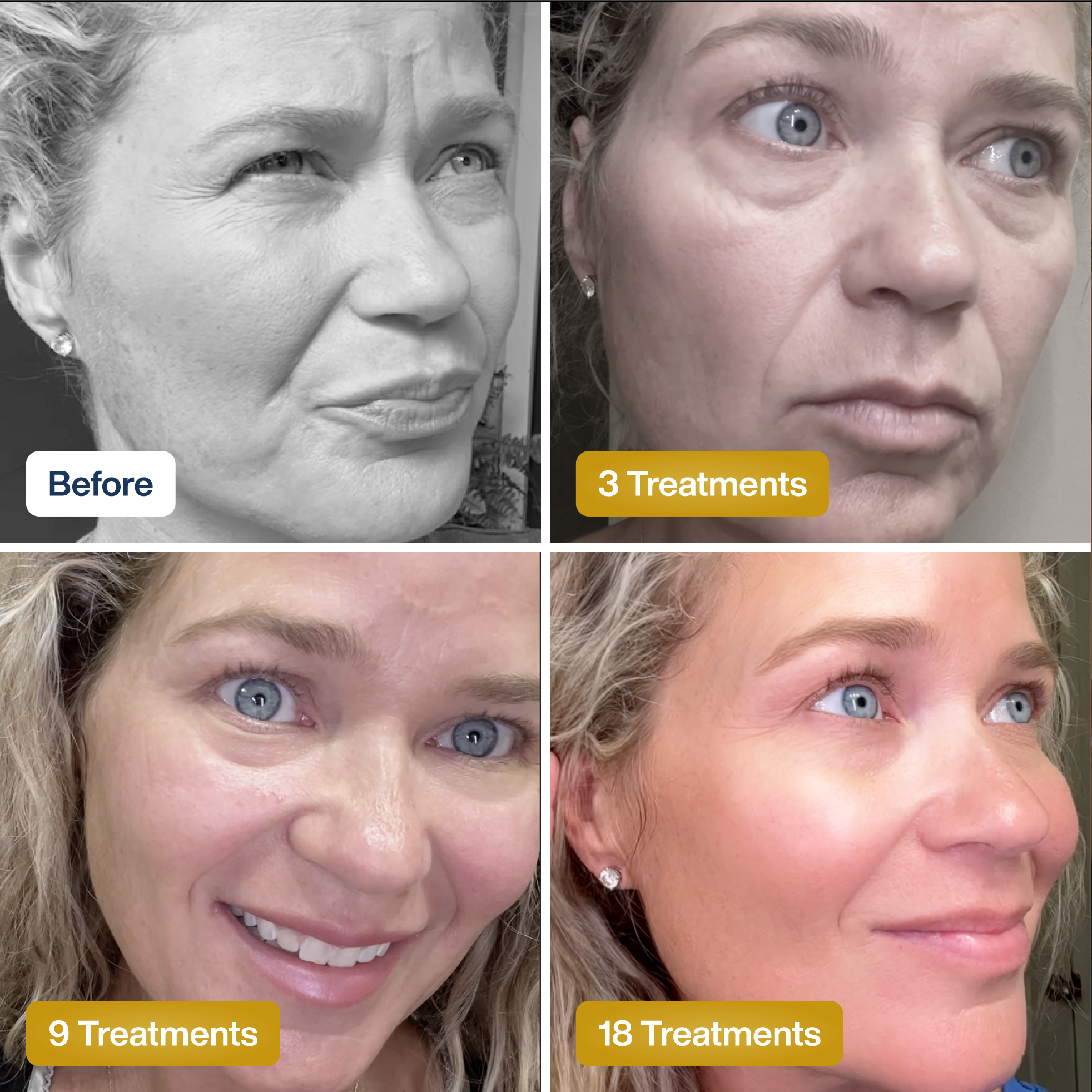 Baby Collagen FACE Mask