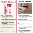 A close-up of Timilk® UltraBond Premium Denture Adhesive tube by Arenzza, showing the product label and packaging.