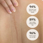 Aurenza Shop DermaShield™ Pro Scar Matrix with medical-grade silicone, designed for scar treatment and skin healing.