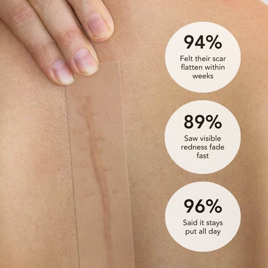 Aurenza Shop DermaShield™ Pro Scar Matrix with medical-grade silicone, designed for scar treatment and skin healing.
