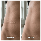 Aurenza Shop DermaShield™ Pro Scar Matrix in packaging, designed for scar treatment and skin healing.