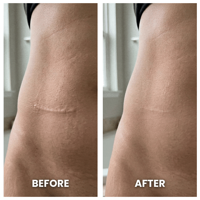 Aurenza Shop DermaShield™ Pro Scar Matrix in packaging, designed for scar treatment and skin healing.