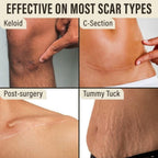 Aurenza Shop DermaShield™ Pro Scar Matrix in packaging, designed for scar treatment and skin healing.