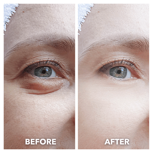 Aurenza LumiLift™ Eye Perfector in a sleek container, showcasing the elegant design of the skincare product for youthful eye area.