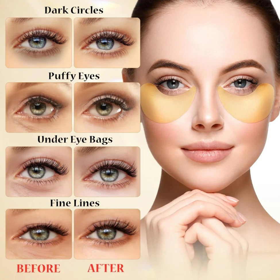 A pack of 60 gold under eye patches from Aurenza Shop, showing the bright, gold-colored patches designed for eye area skincare.