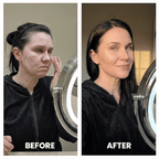 Aurenza Shop ProSculpt™ Neck & Face Lifter demonstrating a sleek white device used for facial and neck lifting.