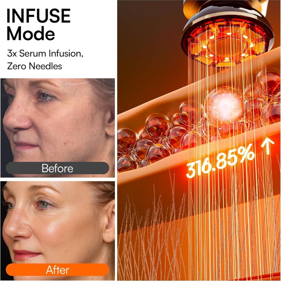 Aurenza ProSculpt™ Neck & Face Lifter in white, showing the sleek, contoured design for facial and neck lifting.