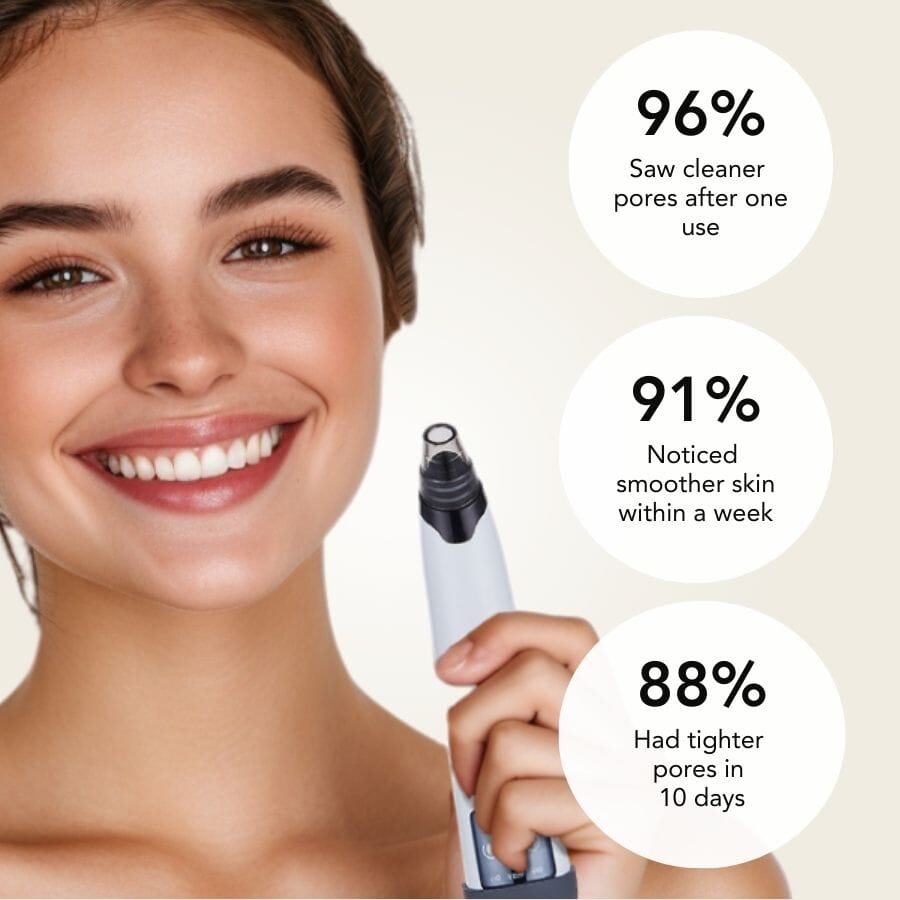 Aurenza Blackhead Remover Pore Vacuum Cleaner showing a handheld device with suction cup for skin pore cleansing.