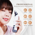 Aurenza Shop blackhead remover pore vacuum cleaner with a sleek black design and multiple suction attachments for skin cleansing.