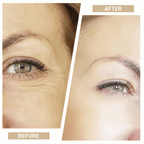 Black Aurenza 3-in-1 Mini Facial Toning & Rejuvenation Device for skin tightening and rejuvenation.