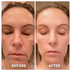 Aurenza 7-in-1 LED facial toning and rejuvenation wand showing multiple LED treatment heads for skin therapy.
