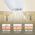 Aurenza Shop IPL Hair Removal Haven device with sleek design, suitable for at-home hair removal treatments.