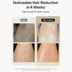 Aurenza Shop IPL Hair Removal Haven device with sleek design and control panel for at-home hair removal treatment.