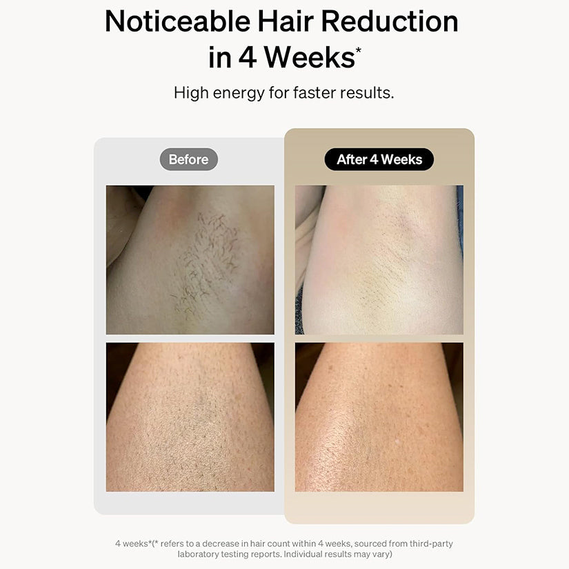 Aurenza Shop IPL Hair Removal Haven device with sleek design and control panel for at-home hair removal treatment.