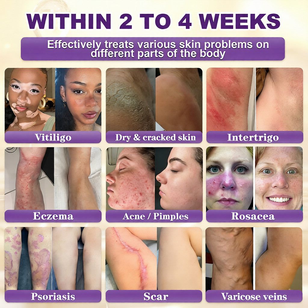 Two jars of Aurenza Shop Biotin 10-in-1 Skin Restoration Cream, made and shipped from the USA, with natural, nourishing skincare.