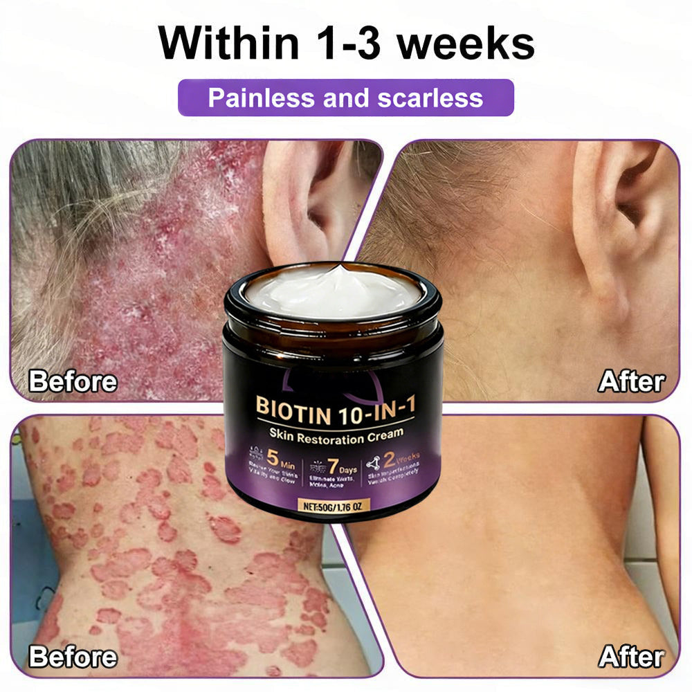 Two jars of Aurenza Shop Biotin 10-in-1 Skin Restoration Cream, made and shipped from the USA, shown side by side.