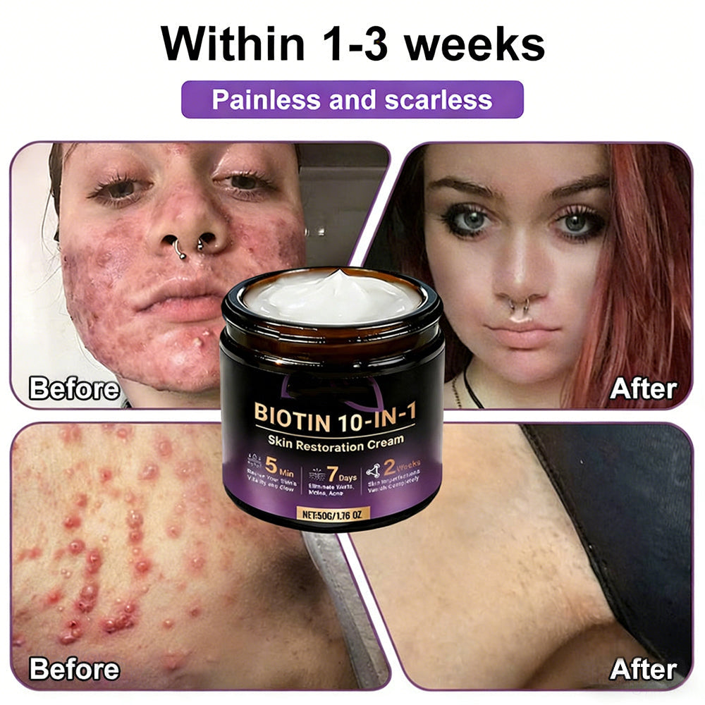 Two jars of Aurenza Shop Biotin 10-in-1 Skin Restoration Cream, made and shipped from the USA, with green leaves and product label.