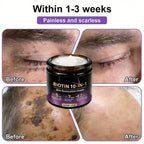 Two jars of Aurenza Shop Biotin 10-in-1 Skin Restoration Cream, made and shipped from the USA, shown with labels visible.