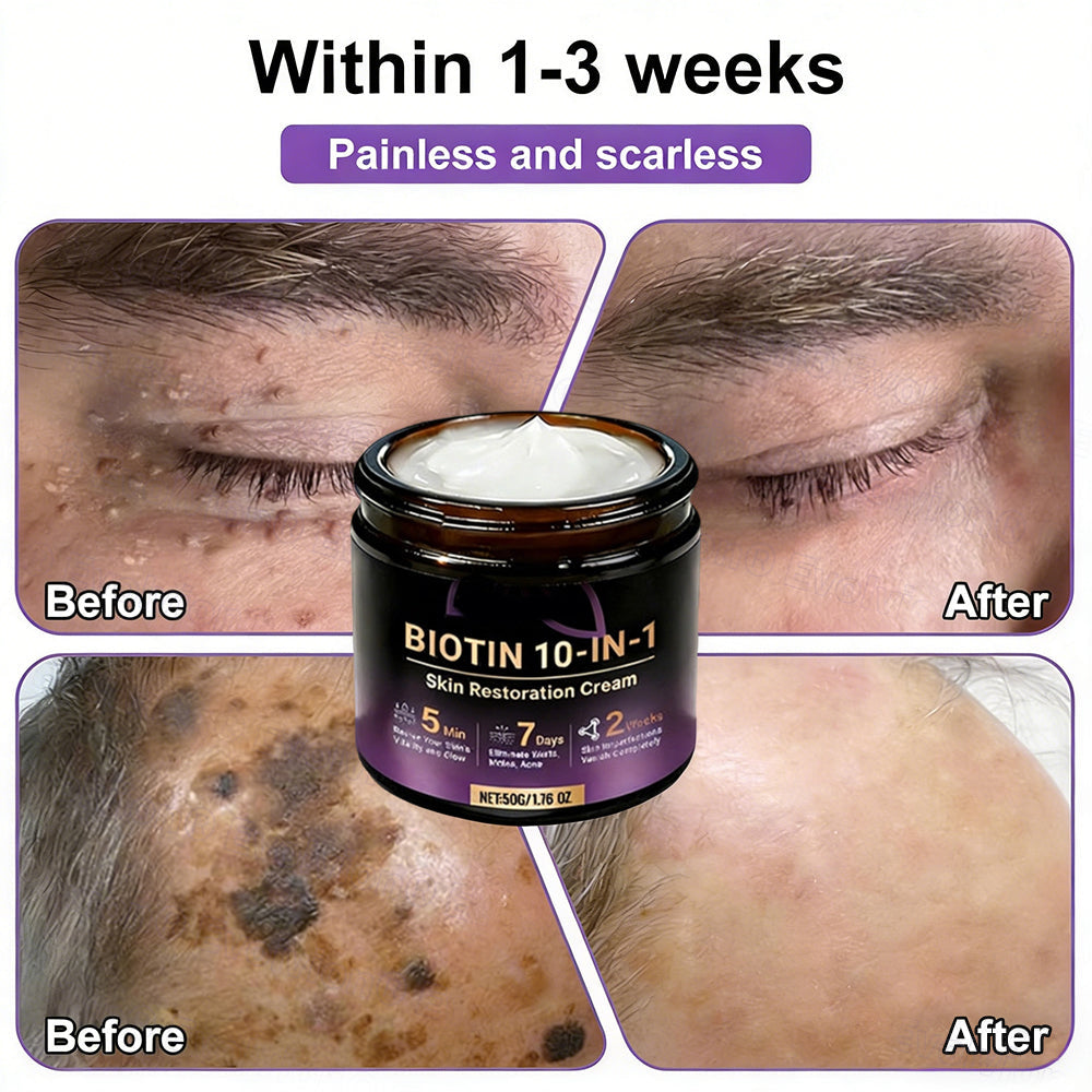 Two jars of Aurenza Shop Biotin 10-in-1 Skin Restoration Cream, made and shipped from the USA, shown with labels visible.