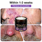 Two jars of Aurenza Shop Biotin 10-in-1 Skin Restoration Cream, made and shipped from the USA, with a natural skincare appearance