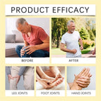 Aurenza Shop bee venom joint pain relief cream jar with label, designed for joint and bone pain relief for men and women.