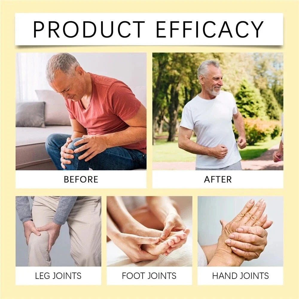 Aurenza Shop bee venom joint pain relief cream jar with label, designed for joint and bone pain relief for men and women.