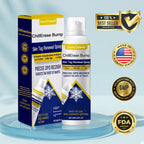 Aurenza DermChiller ChillErase Bump and Skin Tag Renewal Spray bottle on a white background.