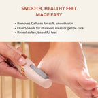 Aurenza SpaSculpt Pro Pedicure & Callus Remover handheld device with ergonomic design for smooth feet care.