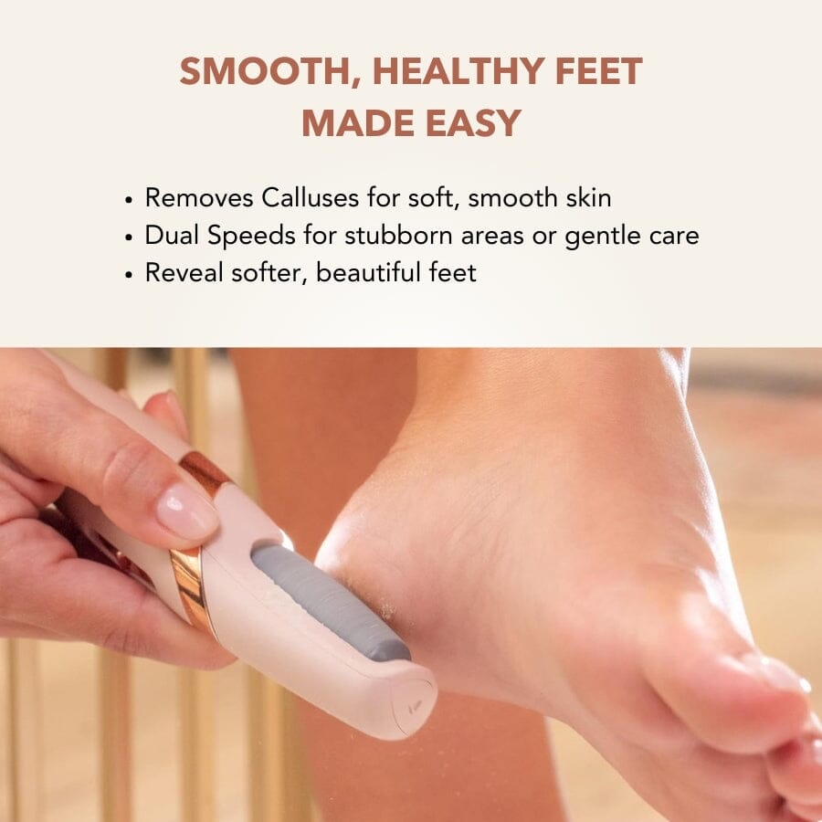 Aurenza SpaSculpt Pro Pedicure & Callus Remover handheld device with ergonomic design for smooth feet care.