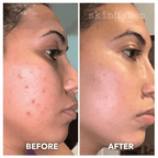 Aurenza Shop Face Mask Light Therapy Gen.2 in gold, with sleek design and adjustable straps for skin rejuvenation treatment.