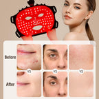 Gold Aurenza Face Mask Light Therapy Gen.2 for skin rejuvenation, shown on a white background with adjustable straps.