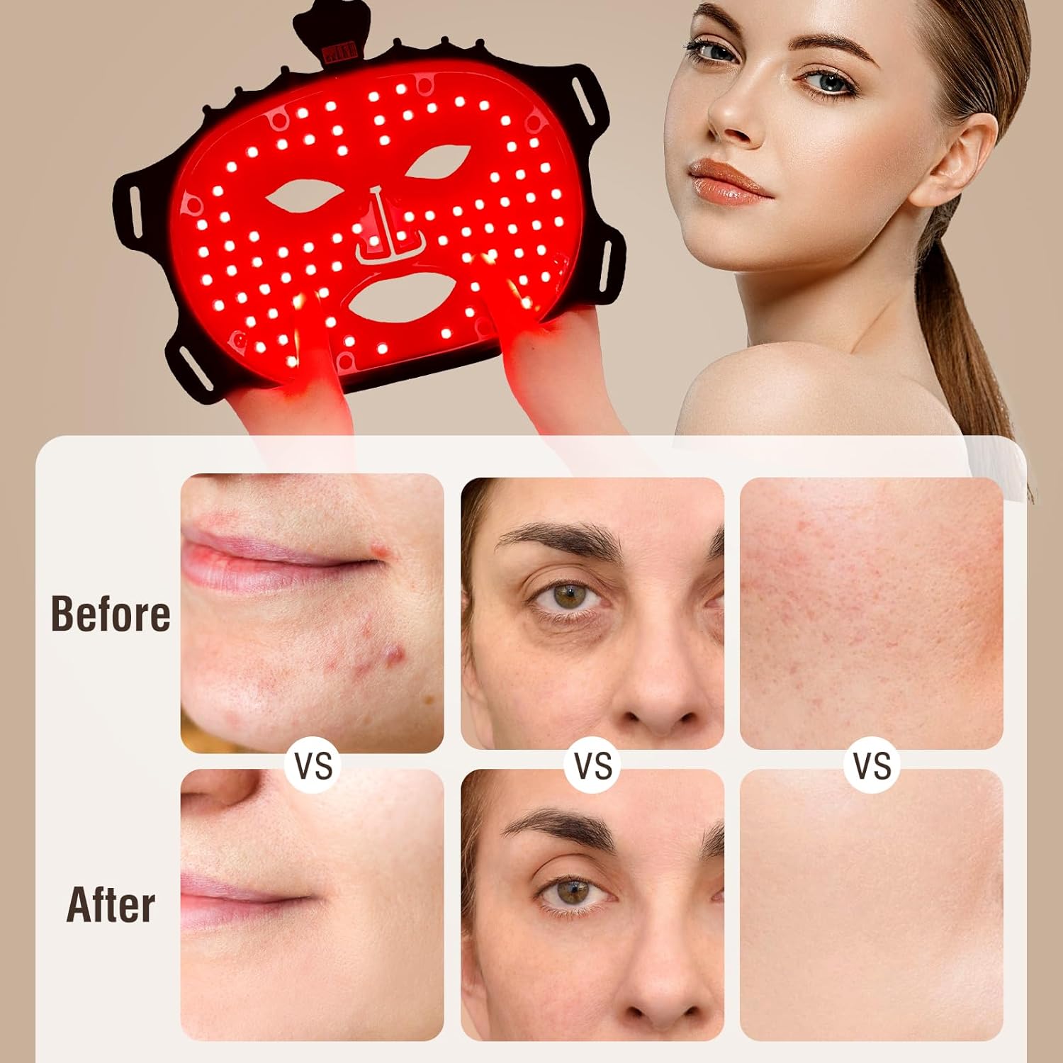 Gold Aurenza Face Mask Light Therapy Gen.2 for skin rejuvenation, shown on a white background with adjustable straps.