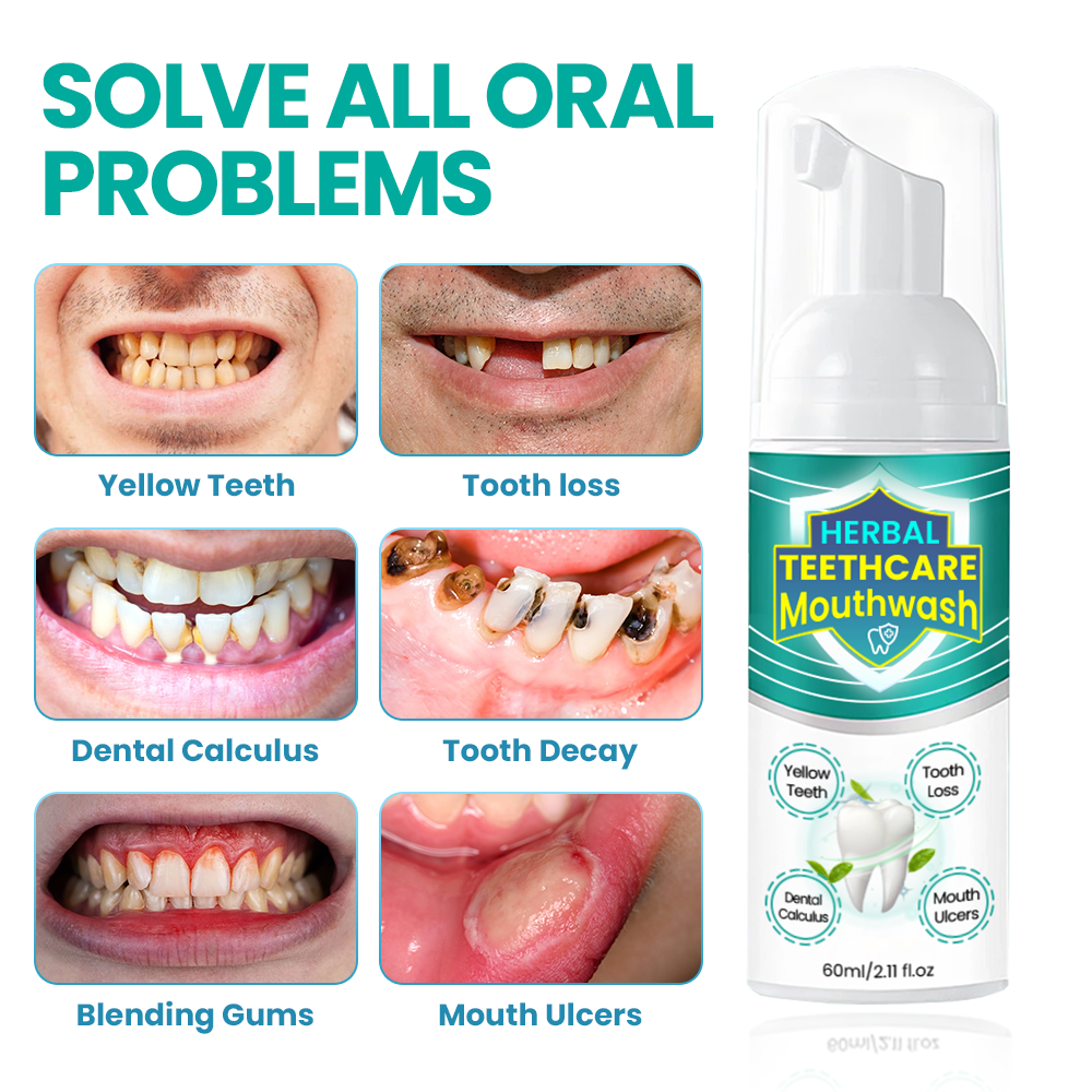 Two bottles of Aurenza Herbal TeethCare Mouthwash with herbal ingredients for oral health and fresh breath.