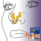 Two white silicone nose clips for anti-snoring nasal dilation to help improve breathing and reduce snoring during sleep.