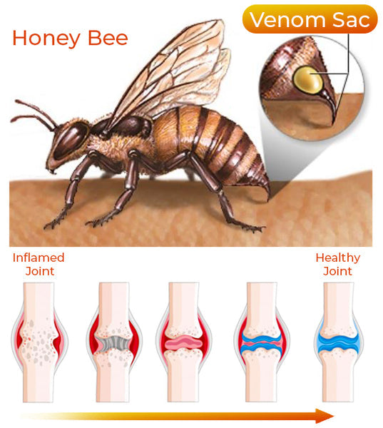 Aurenza Shop Bee Venom Joint and Bone Therapy Advanced Cream jar with label, showcasing the skincare product for joint and bone relief.