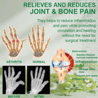 Aurenza Shop Bee Venom Joint and Bone Therapy Advanced Cream jar with a natural skincare background.