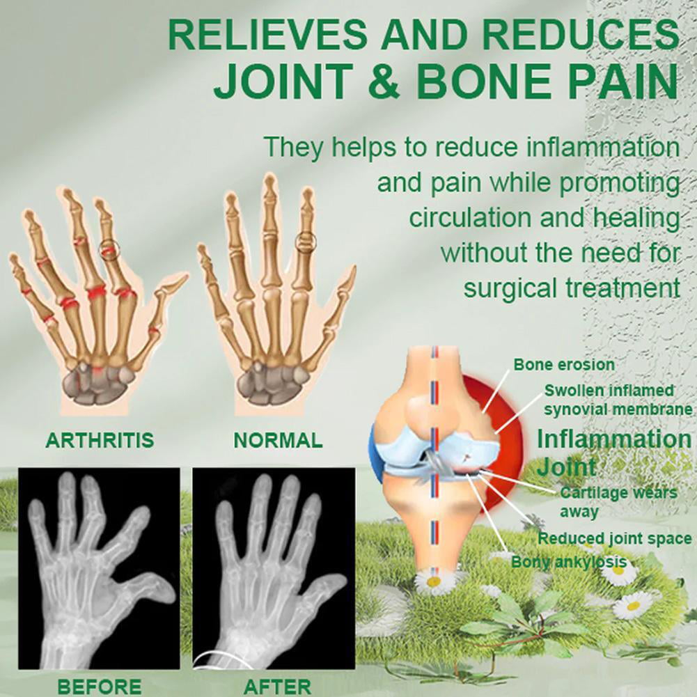 Aurenza Shop Bee Venom Joint and Bone Therapy Advanced Cream jar with a natural skincare background.