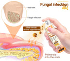 Aurenza Shop Unpree™ Kolirin Bee Venom Nail Fungus Spray bottle for treating nail fungus and nail problems in a beauty and health setting.