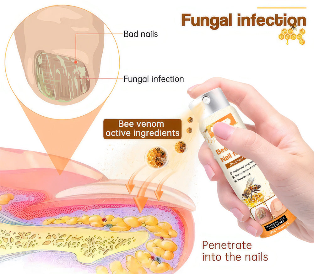 Aurenza Shop Unpree™ Kolirin Bee Venom Nail Fungus Spray bottle for treating nail fungus and nail problems in a beauty and health setting.