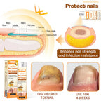 Aurenza Shop Unpree™ Kolirin Bee Venom Nail Fungus Spray bottle for treating nail fungus and nail problems.