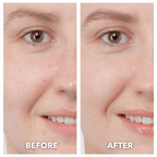 Aurenza ThermaLift 5-in-1 facial sculptor and cleanser device in black, showing its sleek design and multiple treatment heads.