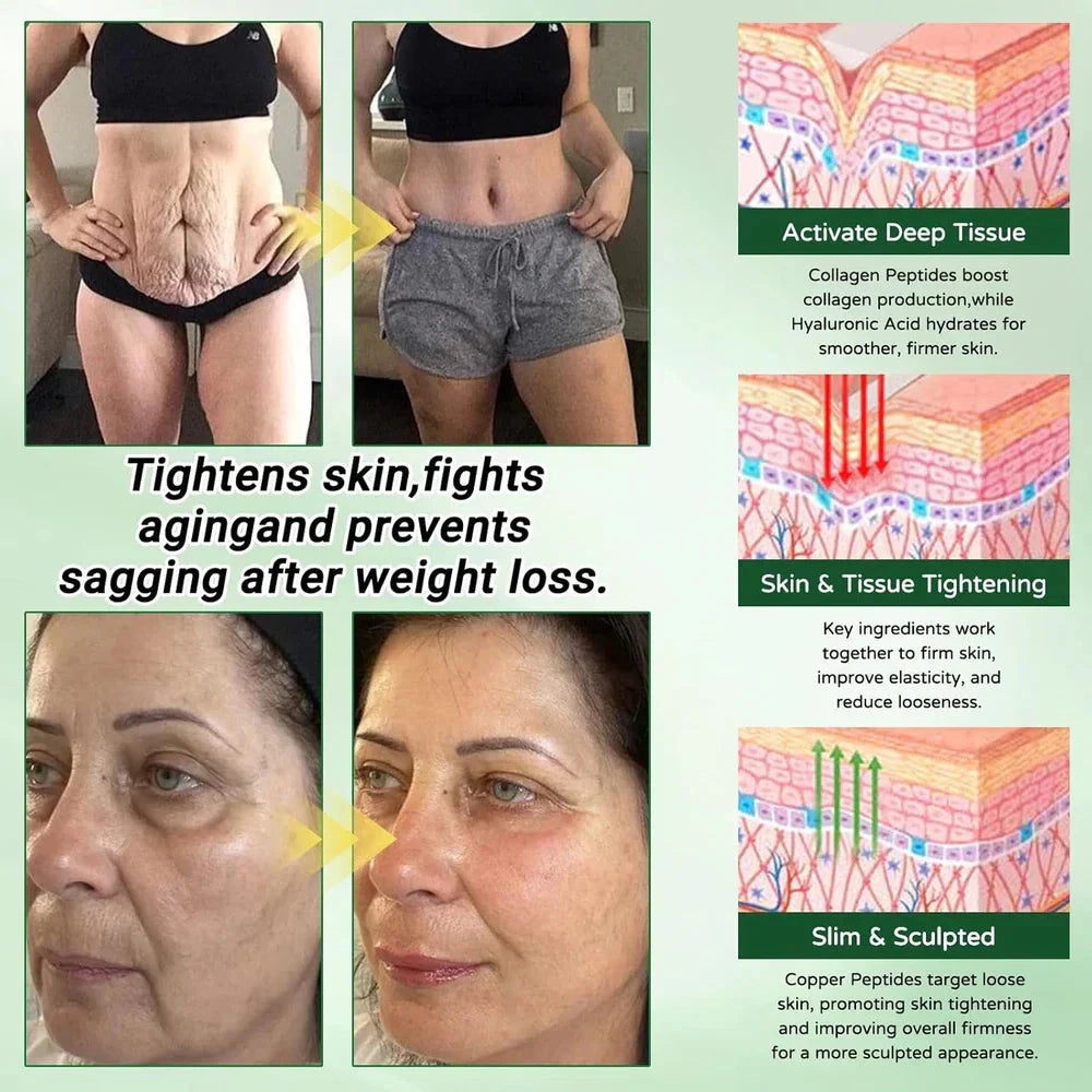 Aurenza Shop Moringa 10-in-1 Advanced Microdarts Nano Patch for weight loss with microneedles, shown on a white background.