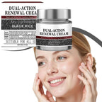 Aurenza Rice Face Renewal Cream 50g jar showing the gentle formula for skin repair, hydration, and revitalization.