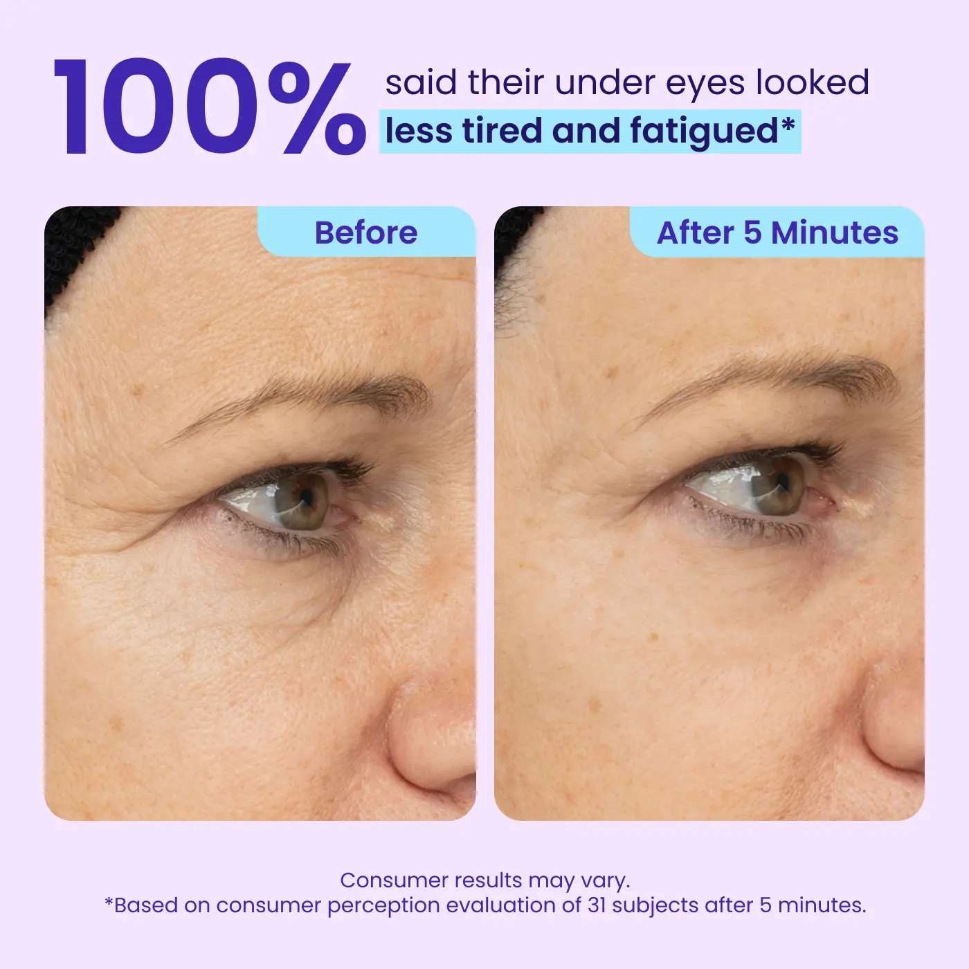 Aurenza Shop WIMAID Eye Cream jar showing its packaging, designed to reduce eye bags and refresh the eye area instantly.