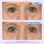 Aurenza Shop WIMAID eye cream jar showing refreshed, bright-eyed look to erase eye bags instantly, with the product label visible.