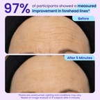 Aurenza Shop WIMAID Eye Cream jar showing application on under-eye area, designed to reduce eye bags and refresh the look instantly.