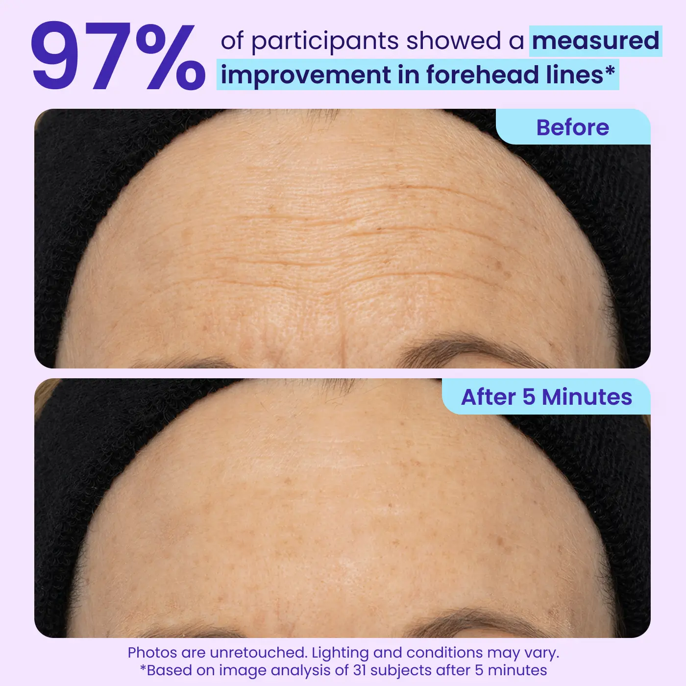 Aurenza Shop WIMAID Eye Cream jar showing application on under-eye area, designed to reduce eye bags and refresh the look instantly.