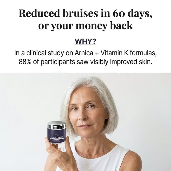 Aurenza Shop bruise repair and skin-strengthening cream, showing the tube with product label and packaging.