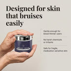 Aurenza Bruise Repair and Skin-Strengthening Cream, tube packaging, designed to reduce bruises and improve skin strength.